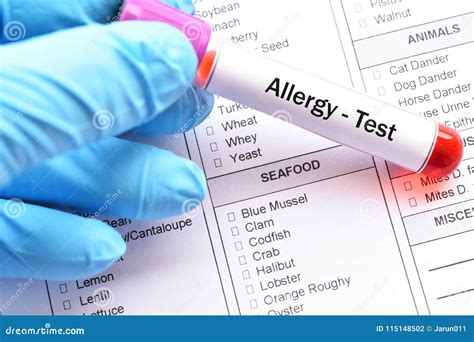 7 drops allergy test|food allergy test.